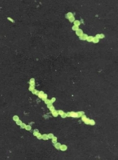 Stained microphotograph of Thiomargarita namibiensis bacteria (Sulfur pearl of Namibia)